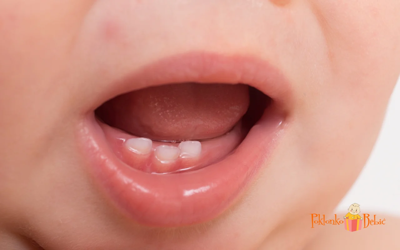 Simptomi rasta zuba kod beba